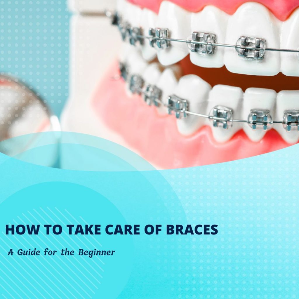 how-to-take-care-of-braces